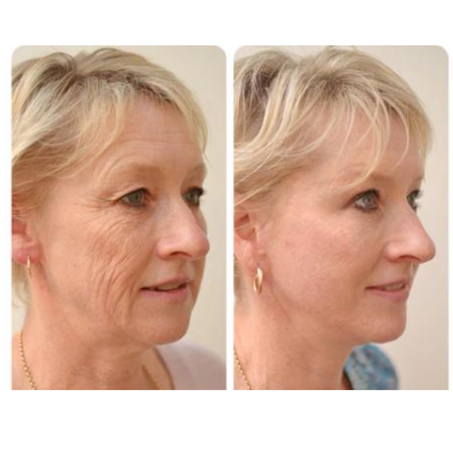 Belani Harumi Serum – Anti-Aging Serum For Face, Reduces Dark Spots & Wrinkles, Hydrating & Moisturizing Formula for a Youthful Glow with HA & Niacinamide (1.01 Fl. Oz)